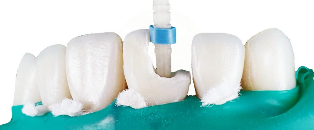 wklad wlokno szklane