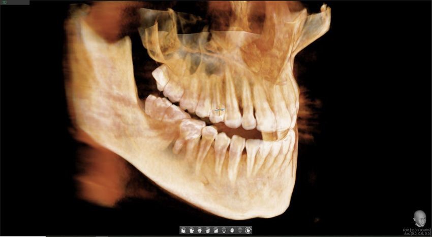 CBCT_zdjecia_3d