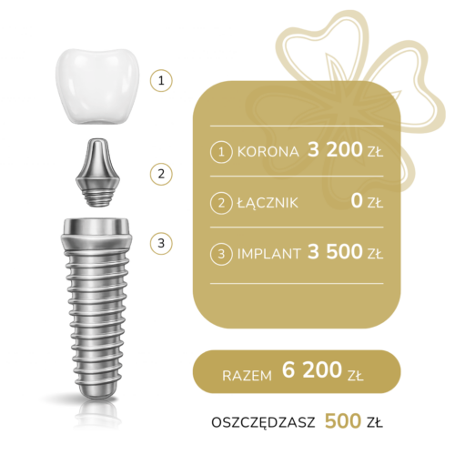 budowa-implant-kovalenko-koszalin