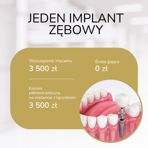 Jeden implant zębowy koszalin kovalenko