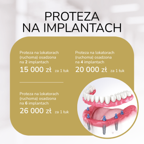 Proteza na implantach kovalenko koszalin