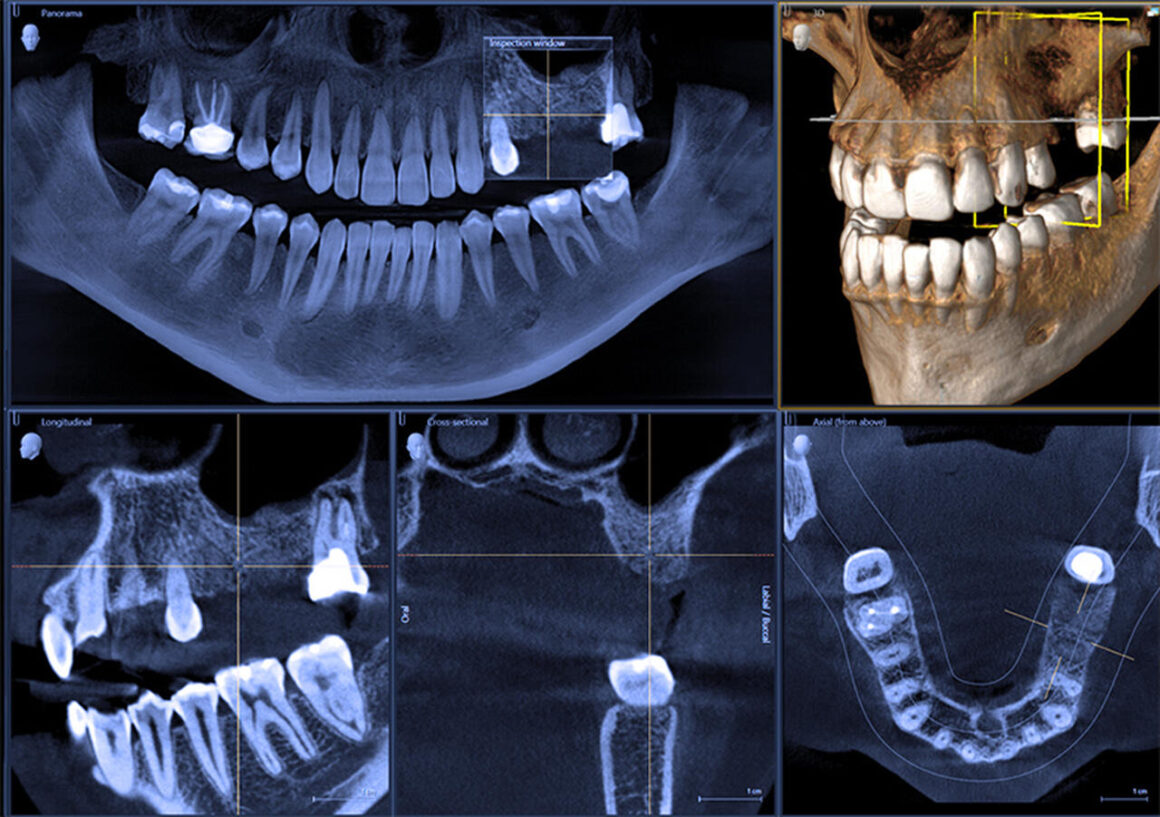 tomografem-3D-CBCT-koszalin tomografem-3D-CBCT-koszalin