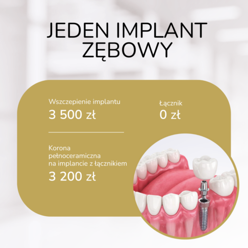 Jeden implant zębowy koszalin kovalenko.