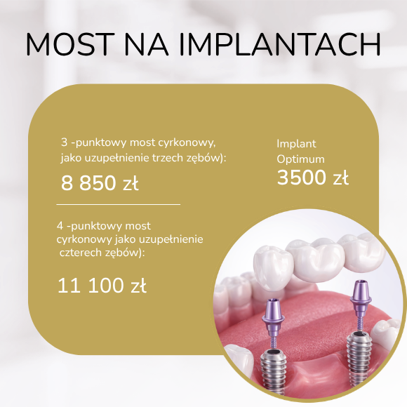 most na implantach koszalin